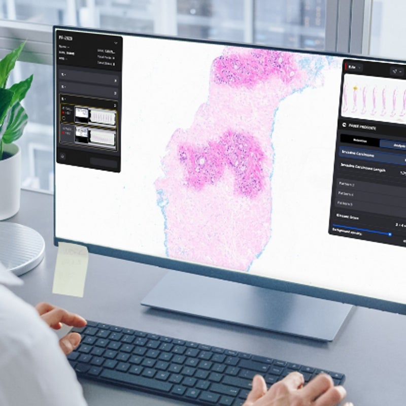 In this image, a healthcare professional is using Paige.ai to look more closely at patient tissues.