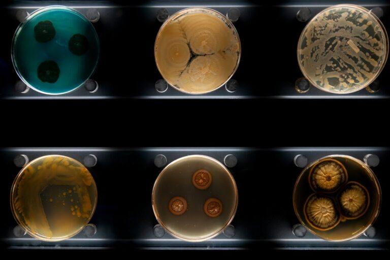 Different types of bacteria, mold and fungi in petri dishes.